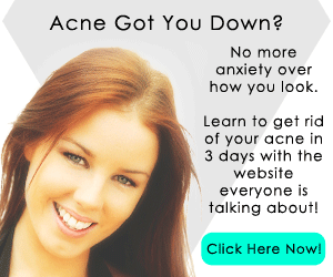 Acne No Morewewqew