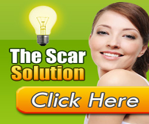 Scar Solution