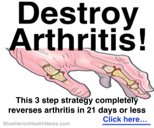 Arthritis