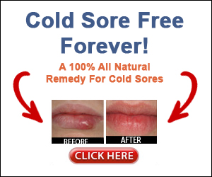 Cold Sore Free