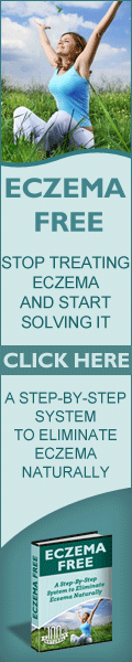 Ezcema Free