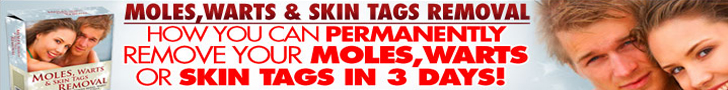 Mole and Warts Removal