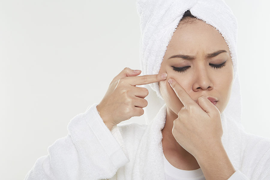 Getting Rid of Acne the Cheap Way