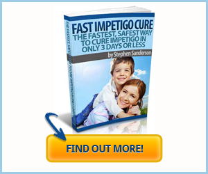 How to Cure Impetigo