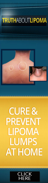 Truth About Lipoma