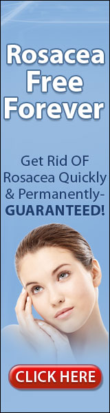 Rosacea Free
