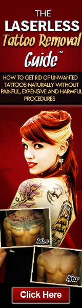 Laserless Tattoo Removal