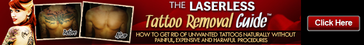 Laserless Tattoo Removal