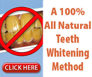 Teeth Whitening for You